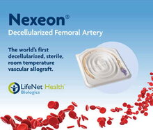 Nexeon: Intended for use as a conduit for blood flow in the peripheral vasculature. 