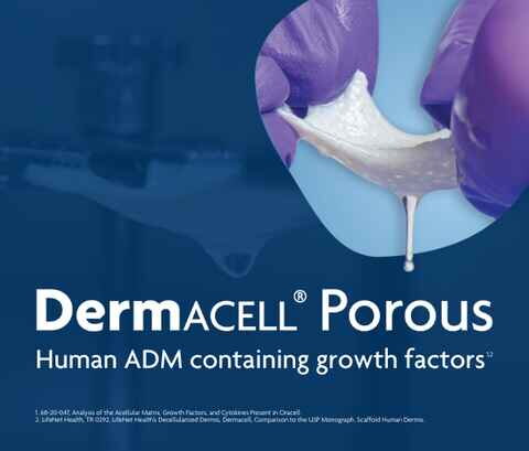 Dermacell Porous Human ADM